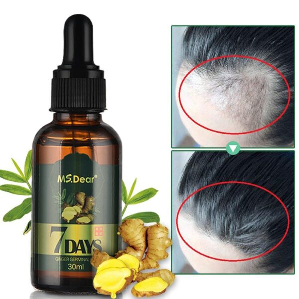 Anti Loss Hair Ginger Essential Oil