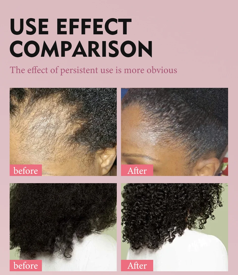 100% Pure Natural Karkar Chebe Oil Batana Butter Hair Growth Oil Rosemary Repair Damaged Hair Treatment Oil Anti-Hair Loss Care