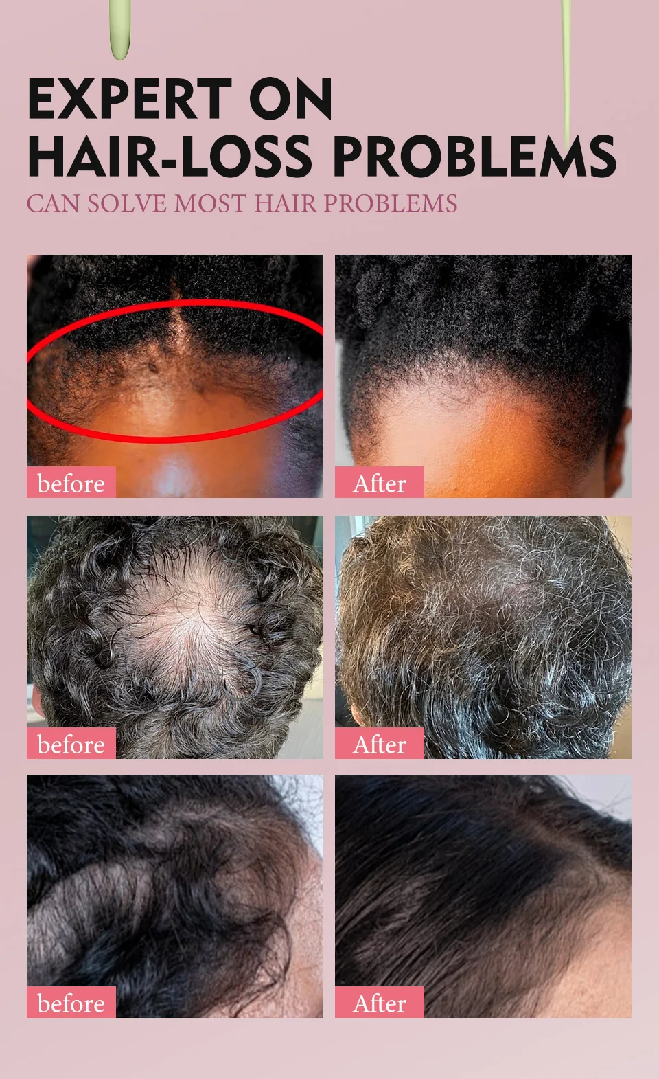 100% Pure Natural Karkar Chebe Oil Batana Butter Hair Growth Oil Rosemary Repair Damaged Hair Treatment Oil Anti-Hair Loss Care