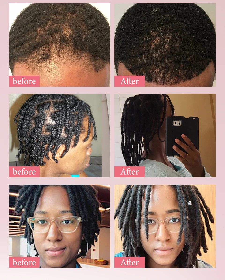 100% Pure Natural Karkar Chebe Oil Batana Butter Hair Growth Oil Rosemary Repair Damaged Hair Treatment Oil Anti-Hair Loss Care