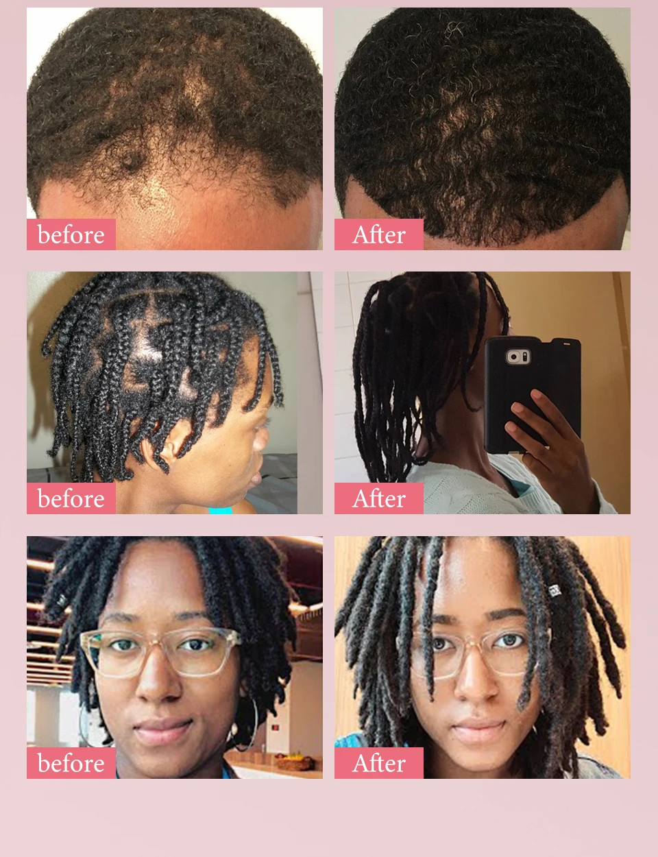 100% Pure Natural Karkar Chebe Oil Batana Butter Hair Growth Oil Rosemary Repair Damaged Hair Treatment Oil Anti-Hair Loss Care