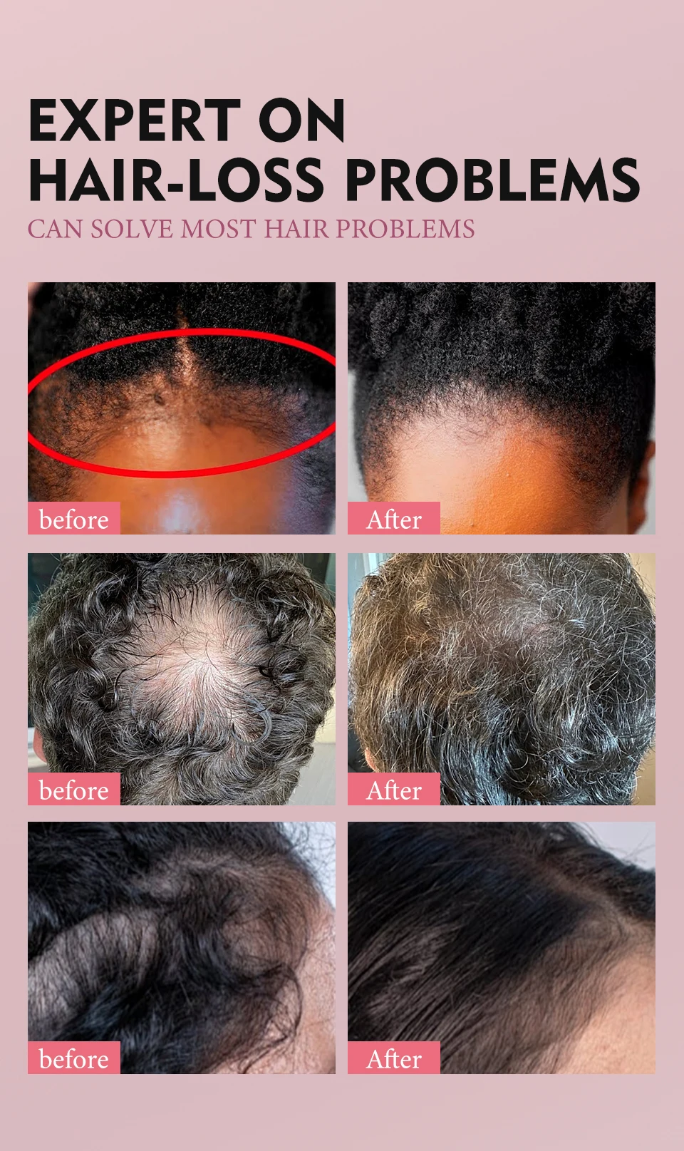 100% Pure Natural Karkar Chebe Oil Batana Butter Hair Growth Oil Rosemary Repair Damaged Hair Treatment Oil Anti-Hair Loss Care